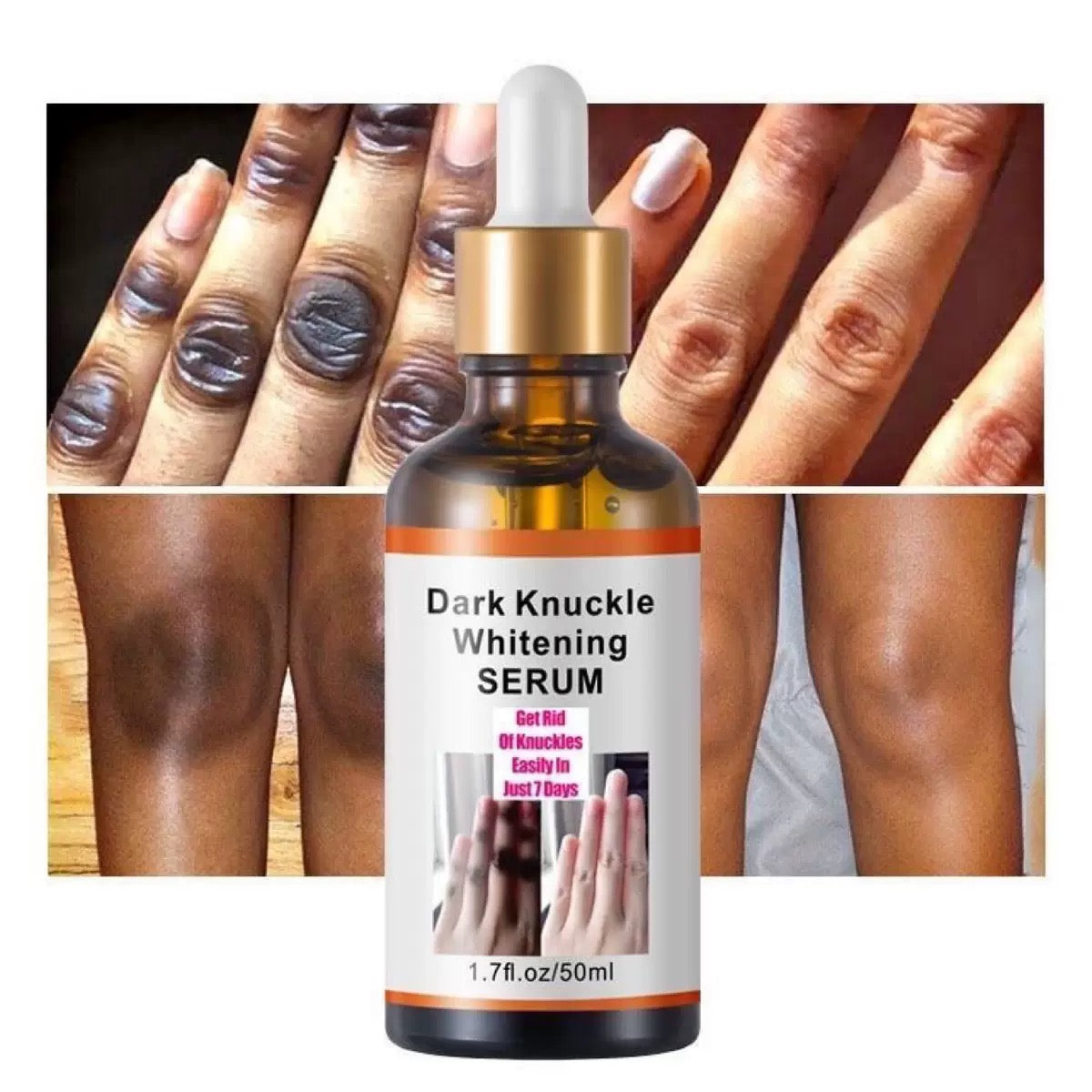 🌟 Sérum Éclaircissant  Anti-Taches Phalanges, Genoux & Coudes – Résultats visibles en 7 j