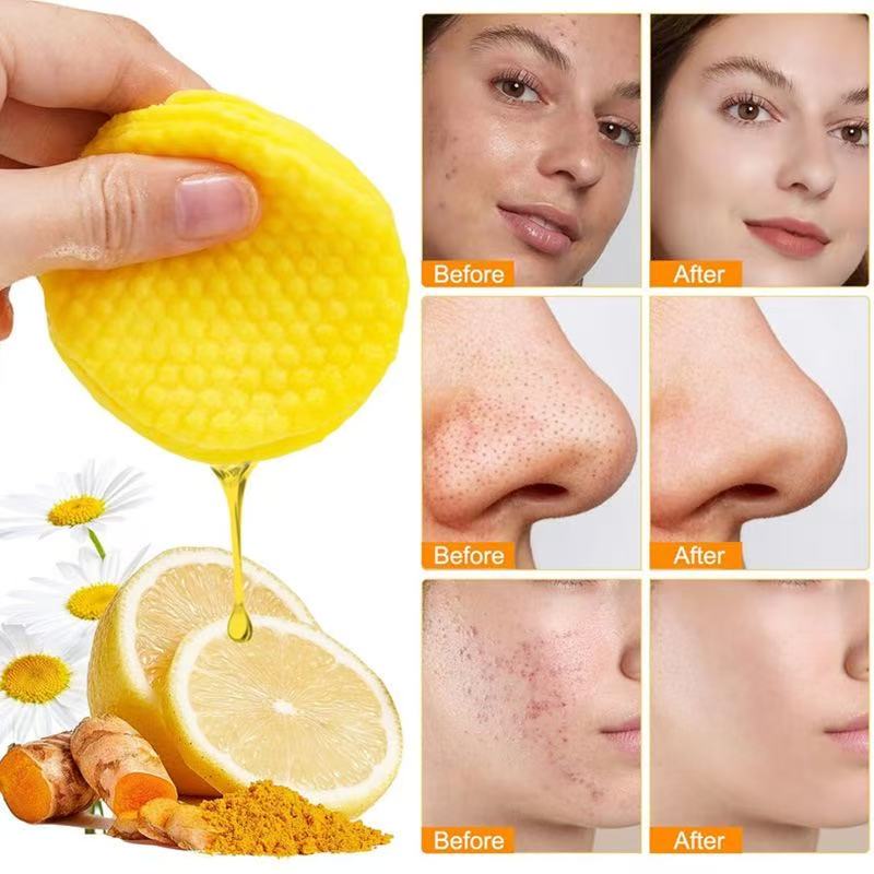 🌟 Golden Glow Pads – Nettoyant Éclat au Curcuma & Acide Kojique